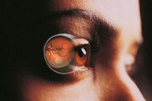 Retinal Photography